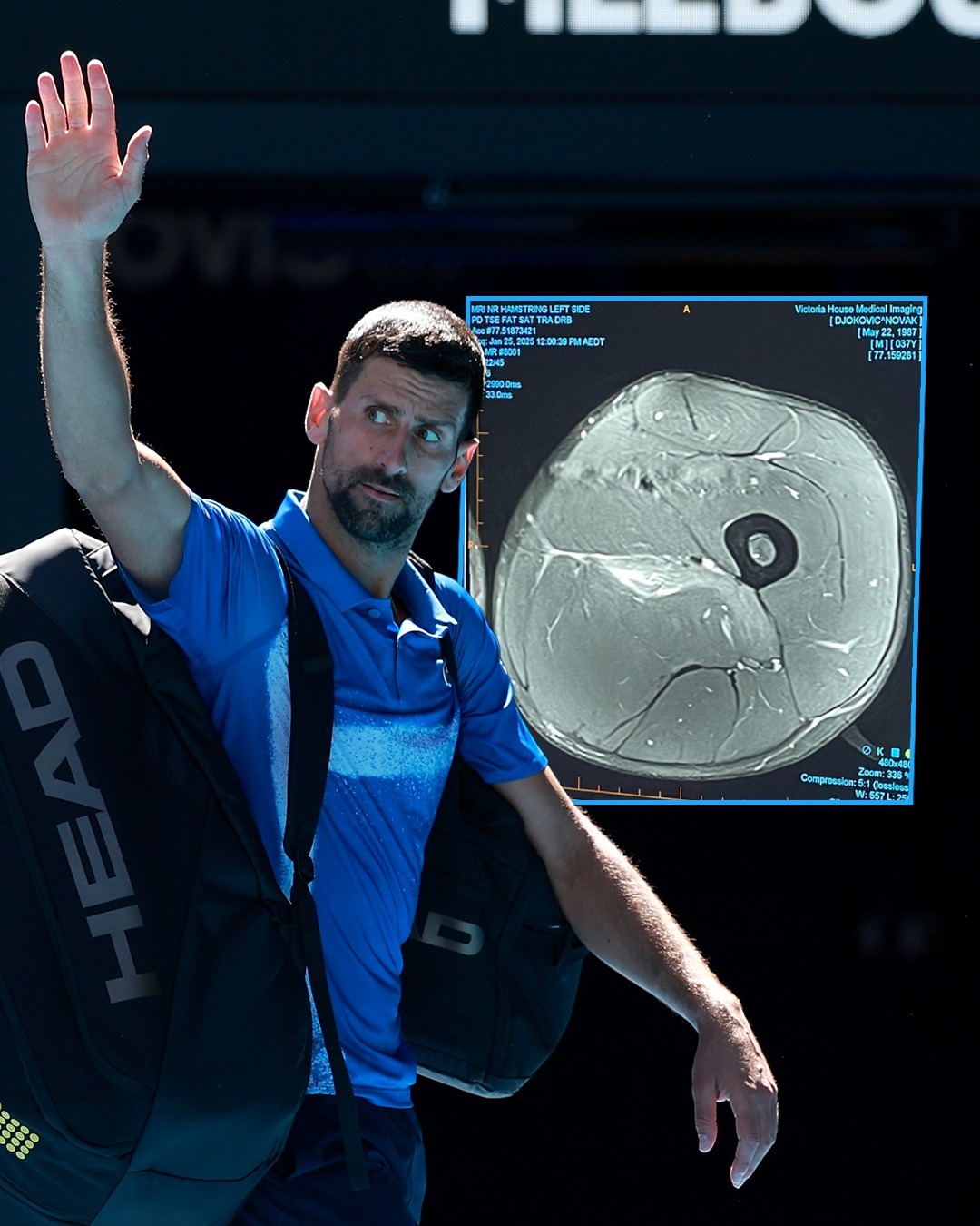 包含美国网球队力克西班牙网球队，德约科维奇绝境逆转的词条